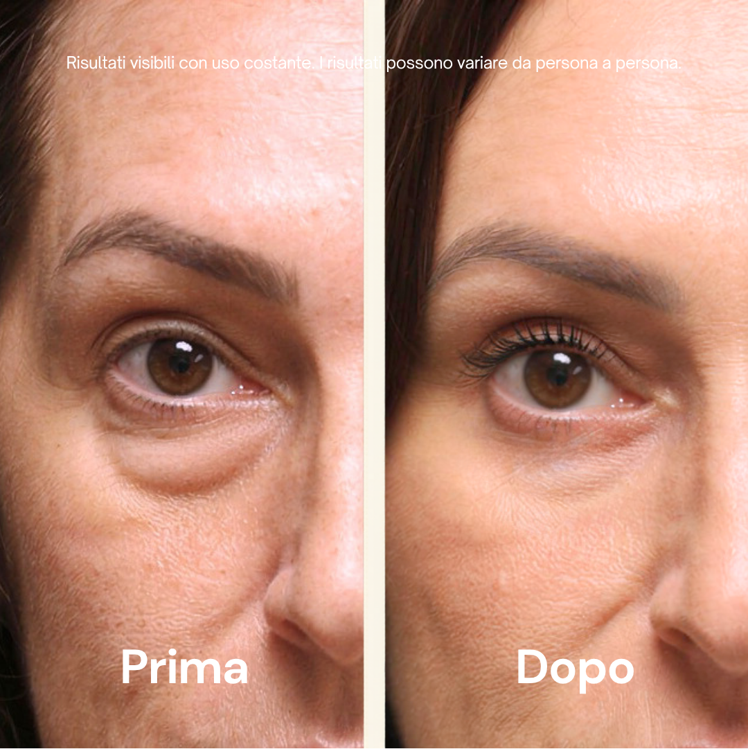 Patch Occhi al PDRN e Collagene — Effetto Tensore Immediato – immagine 3