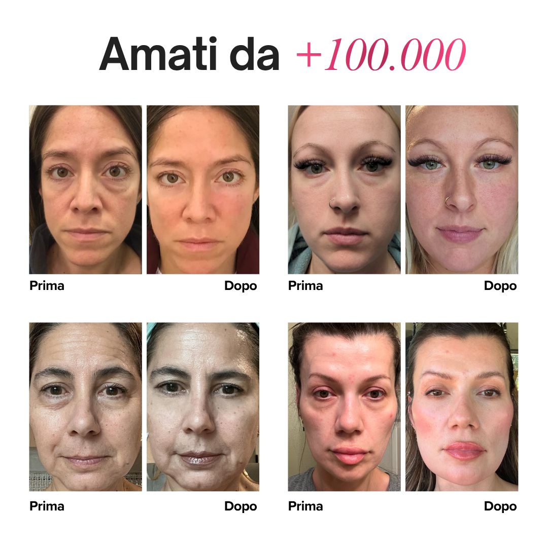 Patch Occhi al PDRN e Collagene — Effetto Tensore Immediato – immagine 5